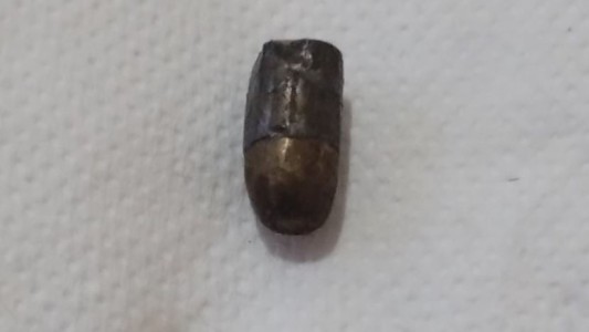 "Precaución": la desagradable sorpresa que se llevó una familia al comprar empanadas