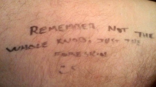 El insólito mensaje de un hombre a su médico antes de su circuncisión