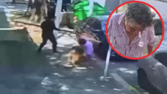 Una mujer atacó salvajemente a un jubilado porque le pidió que levantara la caca del perro