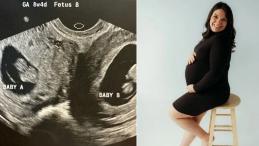 Mujer con inusual útero doble está embarazada en ambos