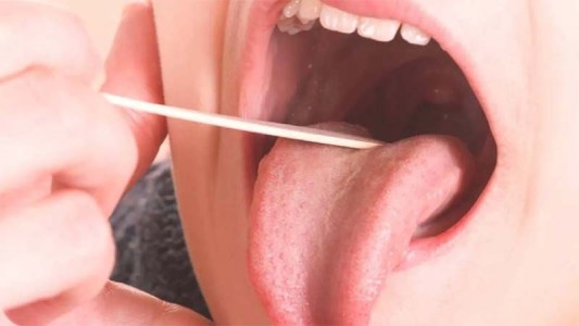 Aumentan los casos invasivos por estreptococo y advierten importancia de no subestimar los síntomas