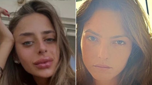 Hamás entregó dos mujeres rehenes, luego de prorrogarse por un día la tregua