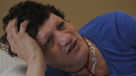 "Pity" Álvarez pierde las cejas pero no las mañas