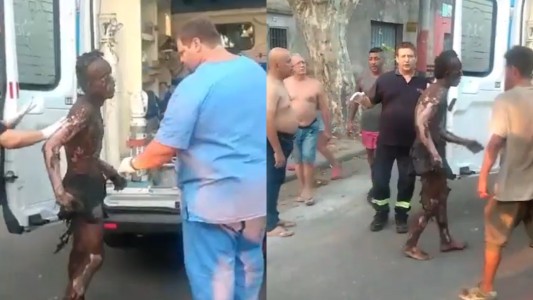 Imágenes sensibles: así quedó el cuerpo del hombre que se electrocutó tratando de robar cables