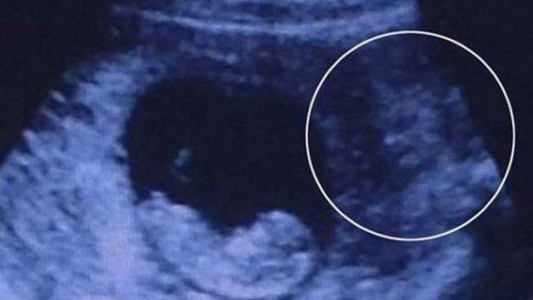 #EsViral Ecografía misteriosa: ¿un "demonio" vigila al feto?