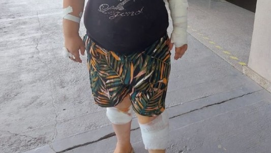 Una jauría atacó a una mujer mientras esperaba el colectivo