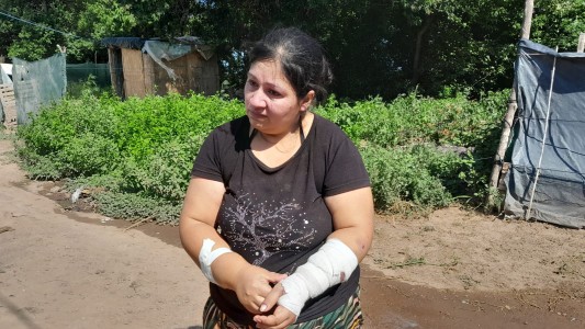 La mujer atacada por una jauría necesita ayuda