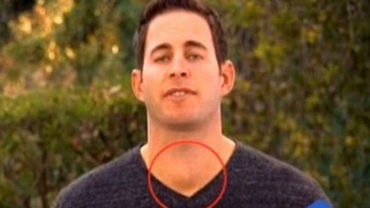 El conductor de tv que se salvó de un cáncer gracias a una televidente