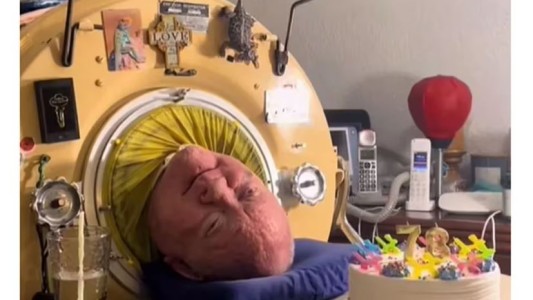 Murió Paul Alexander, el hombre que vivió durante más de 70 años conectado a un pulmón de hierro