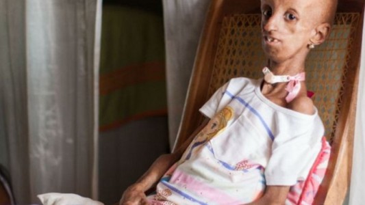 A pesar de su vejez prematura, festejó los 15