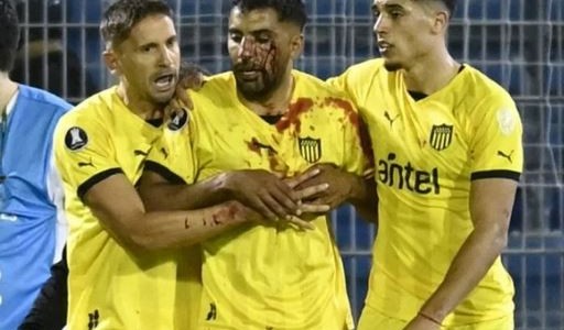 Escándalo: Un jugador de Peñarol recibió un corte tras ser agredido por un hincha de Rosario Central
