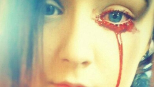 El misterio de la joven que sangra por los ojos