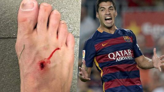 "El fútbol es para hombres", le respondió Suárez  a Filipe Luis tras la foto del pie lastimado