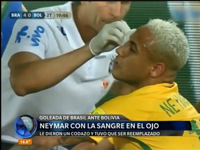 Neymar, con la sangre en el ojo