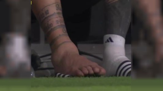 Tremendo: así quedó el tobillo de Messi