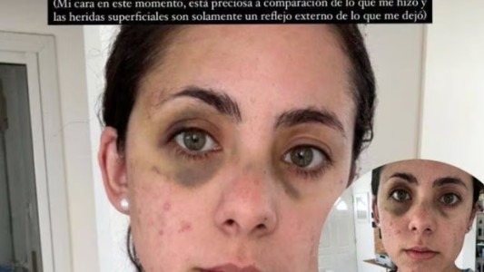 Un fisicoculturista golpeó brutalmente a su pareja en Córdoba