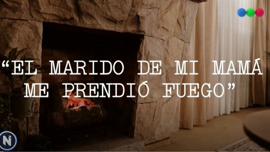 Historias Únicas: "El marido de mi mamá me prendió fuego"