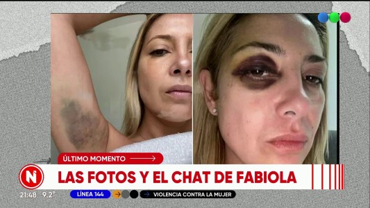 Difunden las fotos de la agresión de Alberto Fernández a Fabiola Yañez