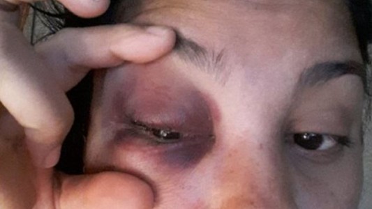 Ex jugador de la selección paraguaya fue escrachado por violencia de género