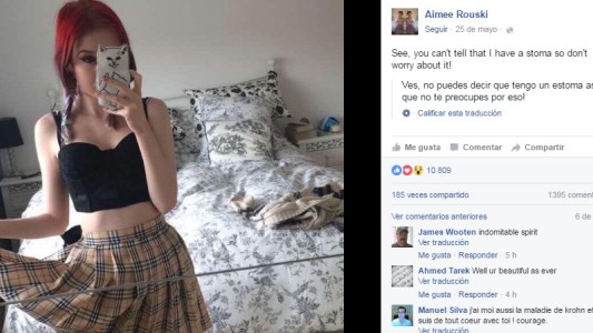 La lección de esta joven sobre los que padecen enfermedades invisibles