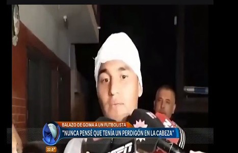 "Estuve a diez centímetros de perder mi carrera", dijo el jugador de Almagro herido con un balazo de goma