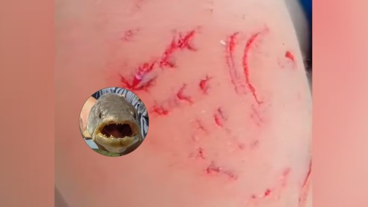 Video: una tararira atacó a un nene en un río de Córdoba