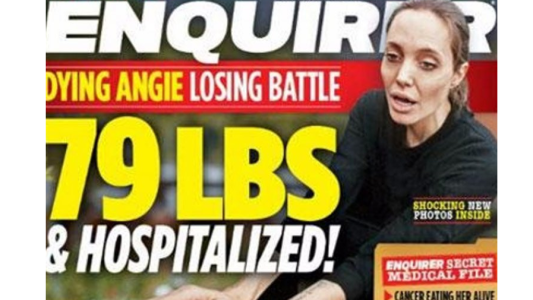 Preocupa Angelina Jolie: aseguran que pesa 35 kilos