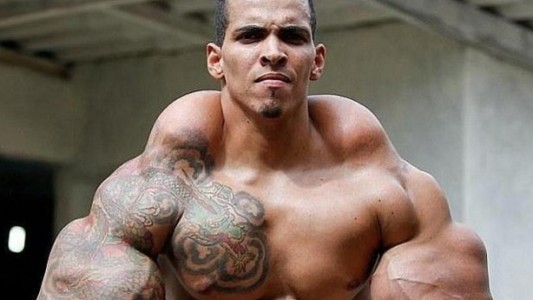 La historia del "Hulk humano" que se deshinchó para evitar la amputación de sus brazos