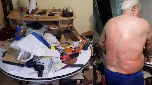 Entradera en Lomas del Mirador: quemaron con agua hirviendo a un abuelo