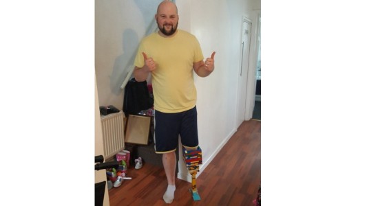 La historia del hombre que construyó su prótesis con piezas de LEGO