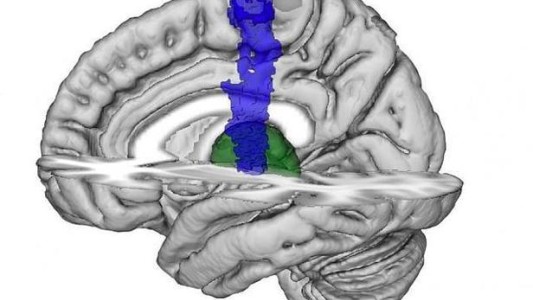 La mujer que estuvo en coma 4 años, se despertó y empezó a cantar canciones de Julio Iglesias