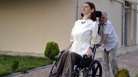 La triste historia de la joven mujer más alta del mundo