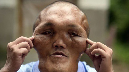 El hombre con "cara de alien" que conmociona a China