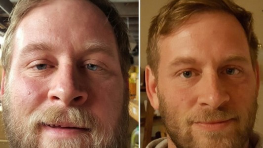 Las fotos del antes y después de un joven alcoholico en recuperación