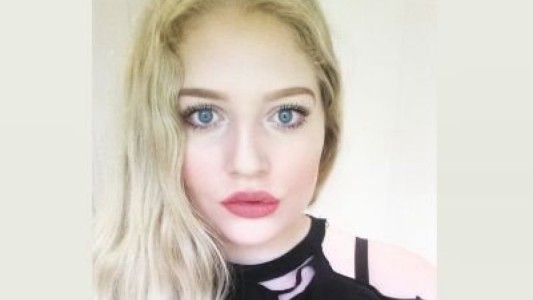 La historia de la joven que intentó quitarse la vida porque se siente "demasiado fea"