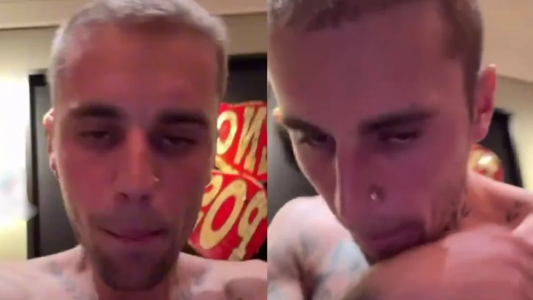 Preocupación por la salud de Justin Bieber: el extraño gesto de su esposa Hailey