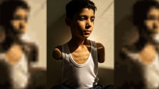 La imagen de un niño mutilado en Gaza ganó el premio a la Foto del Año