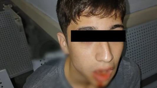 Un adolescente golpeó a otro y le fracturó la mandíbula durante un partido de fútbol