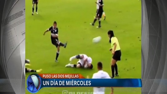 Un día de miércoles: pelotazo en la cara y los peores pateadores