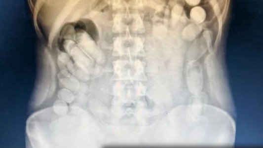 Tucumán: detienen a una pasajera que había ingerido más de 100 cápsulas de cocaína