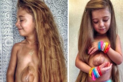 El extraño caso de la nena que nació con el corazón fuera del pecho