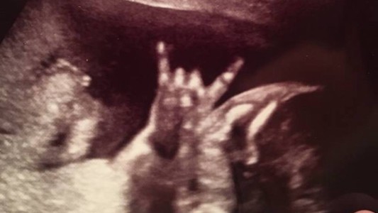 Un bebé hace la señal de "Rock and Roll" durante una ecografía