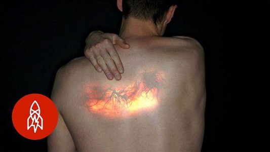 La mujer que tiene la extraña enfermedad que la hace sentir en la piel todo lo que ve