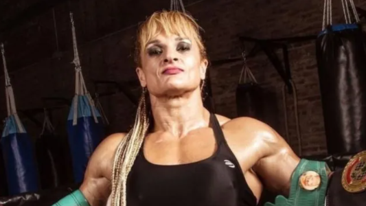 "Locomotora" Oliveras muestra una leve mejoría, pero su pronóstico sigue siendo reservado