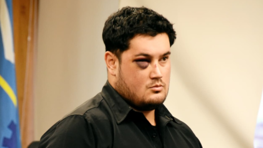 “Me tendría que haber dejado pegar”: insólita disculpa del hombre que le cortó la mano a otro con un machete