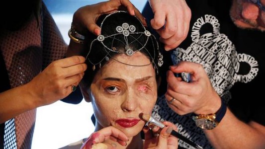 La joven india que sobrevivió a un ataque con ácido desfiló en Nueva York