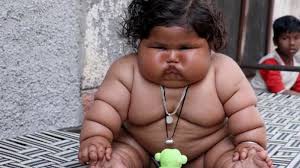 La historia de la bebé india de ocho meses que pesa 17 kilos: "Come como una niña de diez años"