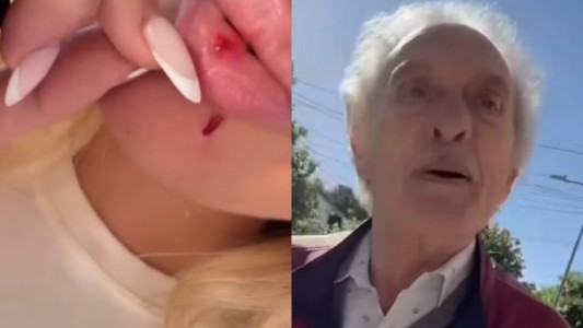 Un jubilado atacó a una joven por estacionar frente a su casa