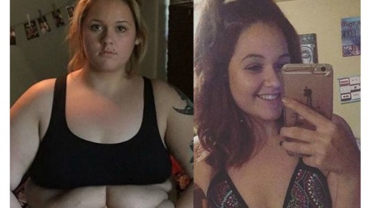 La historia de la joven que adelgazó 76 kilos y pudo usar bikini por primera vez