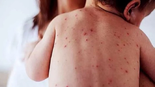 Caída histórica de la vacunación en Argentina: ninguna vacuna llegó al 95% de cobertura